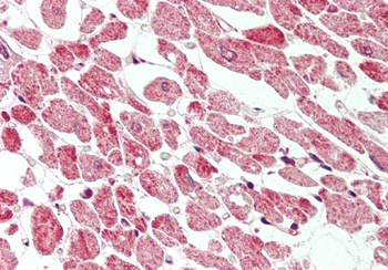 Beclin 1 antibody