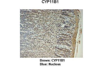CYP11B1 antibody