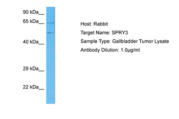 SPRYD3 Rabbit Polyclonal Antibody
