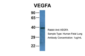 VEGFA antibody