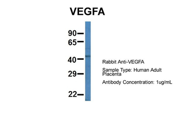 VEGFA antibody