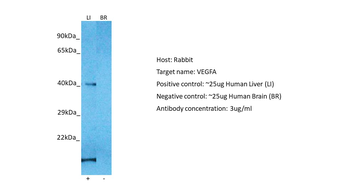 VEGFA antibody