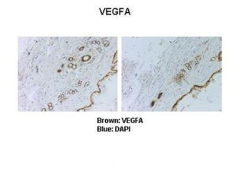 VEGFA antibody