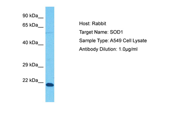 SOD1 antibody