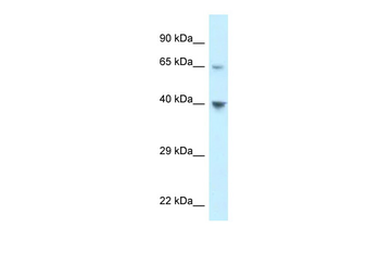 CCRL1 antibody