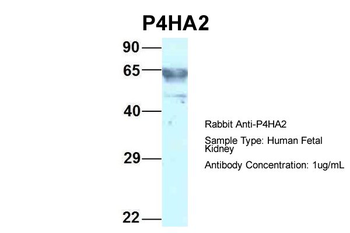 P4HA2 antibody