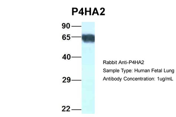 P4HA2 antibody