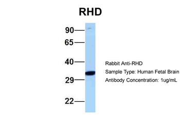 RHD antibody
