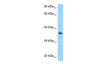 KIR2DL1 antibody