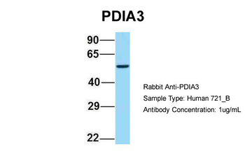 PDIA3 antibody