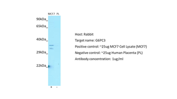 G6PC3 antibody