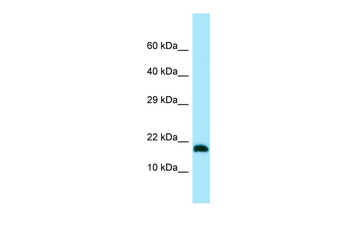 UBE2V2 antibody