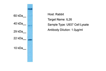 IL26 antibody