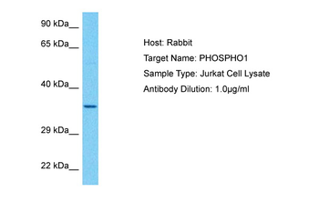 PHOSPHO1 antibody