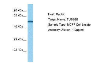 TUBB2B antibody