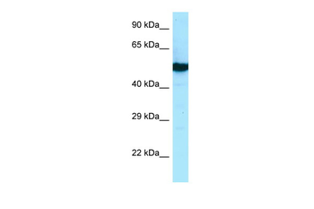 TUBB2B antibody