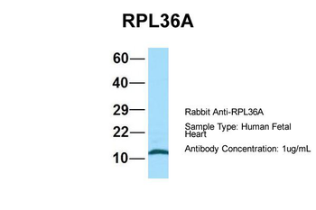 RPL36AL antibody