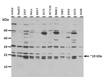 MYLPF Rabbit Polyclonal Antibody