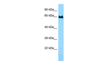 TBC1D3 antibody