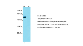 MEX3A antibody