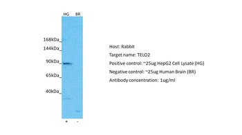 TELO2 Rabbit Polyclonal Antibody