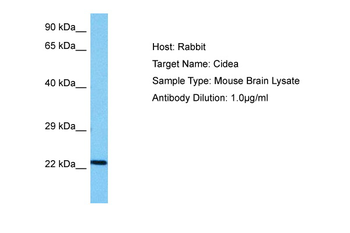 CIDEA antibody
