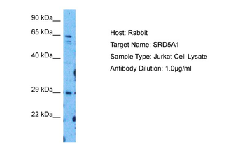 SRD5A1 antibody
