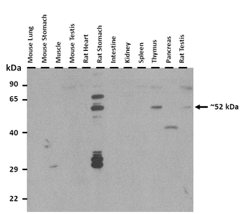 RIPK3 Rabbit Polyclonal Antibody
