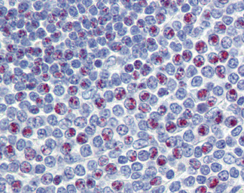 FOXM1 antibody