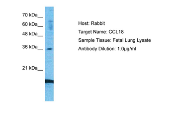 CCL18 antibody