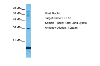 CCL18 antibody