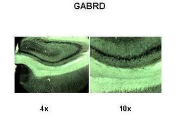 GABRD antibody