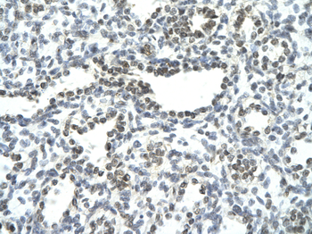 NFATC3 antibody