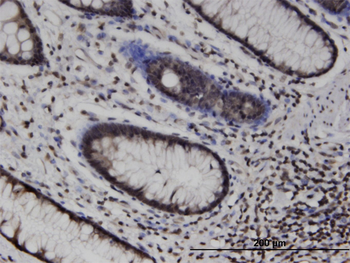 MLKL monoclonal antibody (M02), clone 3B2