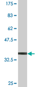 MLKL monoclonal antibody (M02), clone 3B2