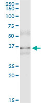 MSI2 monoclonal antibody (M11), clone 3B6