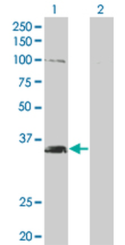 MSI2 monoclonal antibody (M11), clone 3B6