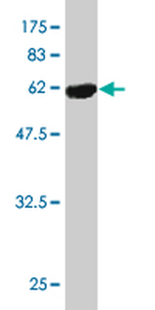 MSI2 monoclonal antibody (M11), clone 3B6