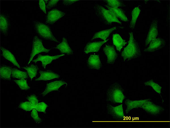 NEK9 monoclonal antibody (M01), clone 1F6