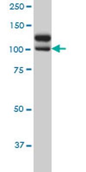 NEK9 monoclonal antibody (M01), clone 1F6