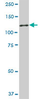 NEK9 monoclonal antibody (M01), clone 1F6