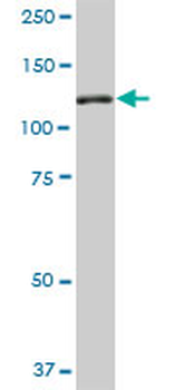 NEK9 monoclonal antibody (M01), clone 1F6