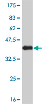 NEK9 monoclonal antibody (M01), clone 1F6