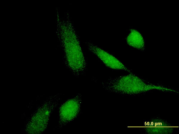 ABCC11 monoclonal antibody (M02), clone 4H6