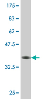 ABCC11 monoclonal antibody (M02), clone 4H6