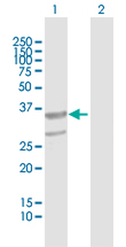 ABHD11 purified MaxPab mouse polyclonal antibody (B01P)