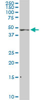 ADPGK monoclonal antibody (M01), clone 1E4