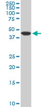 ADPGK monoclonal antibody (M01), clone 1E4