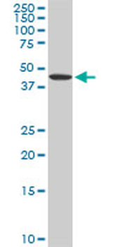 ADPGK monoclonal antibody (M01), clone 1E4