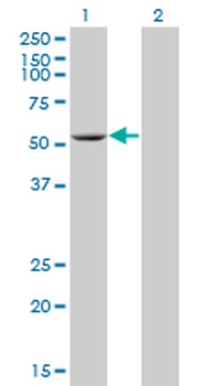 ADPGK monoclonal antibody (M01), clone 1E4